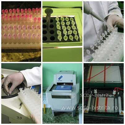 foto-diagnostic-si-diferentiere-serologica-si-moleculara-15